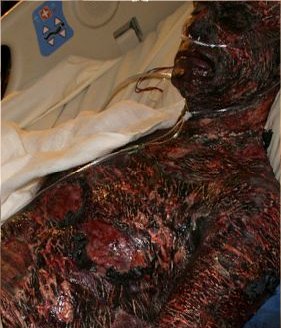 Fichier:Makeup Nathan in a hospital bed.jpg