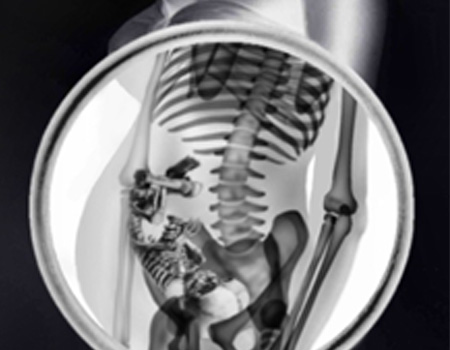 File:Xray vision.jpg