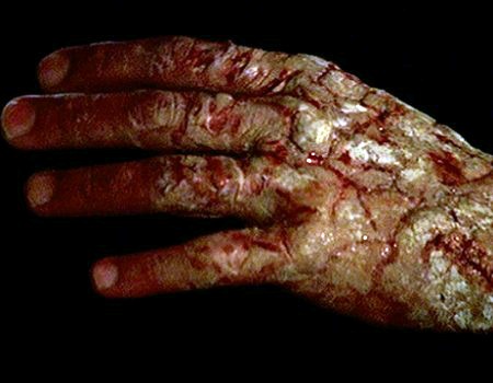 File:Amid Halebi's hand.jpg