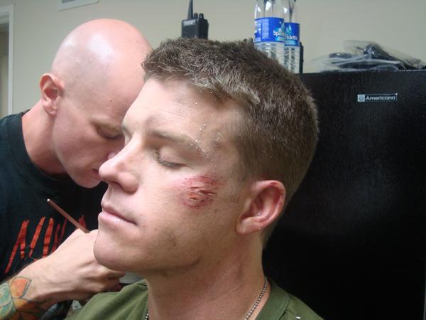 File:Drew applies abrasion to David Sullivan.jpg