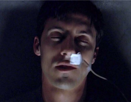 File:Peter's nasal shunt.jpg