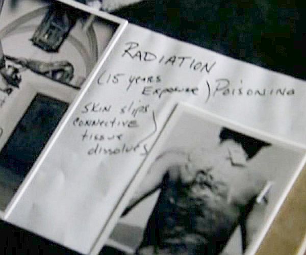 File:Genesis files radiation poisoning.jpg