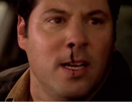 File:Matt nosebleed.jpg