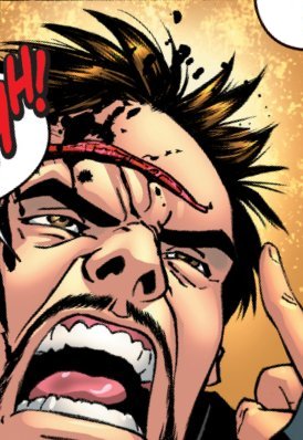 File:Gael gets his head split.jpg