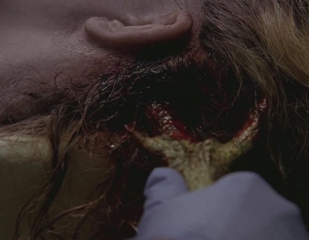 Fichier:Claire has a headache.jpg