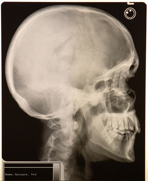 File:Ted brain scan.jpg