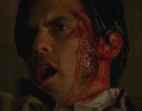 Peter healing after falling off a stadium.